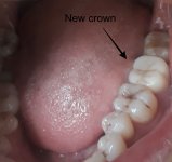 New crown.jpg
