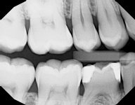 X04294_1.JPG