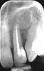 x-ray Oct 24.jpg