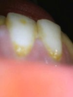 IMG_20241102_003907_866.jpg