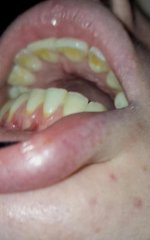 IMG_20241105_224653_896.jpg