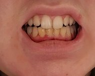 20250515_194622.jpg
