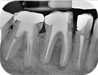 tooth.png