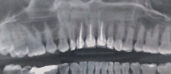 20250903_083813.jpg
