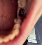 IMG_6415.jpeg