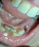 Tooth one.jpg