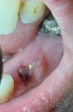 Tooth 2.jpg