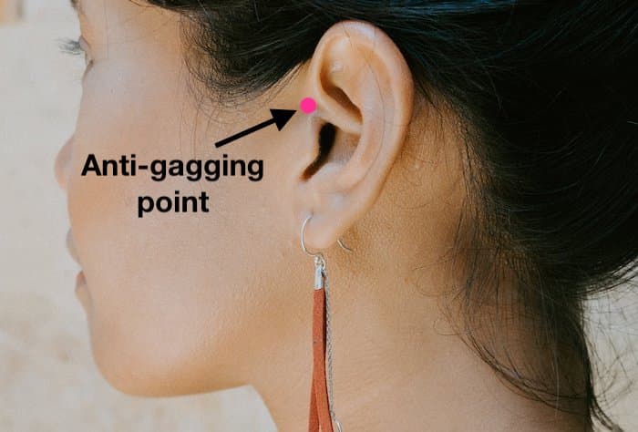 A photo showing the anti-gagging accupressure points just in front of the ears