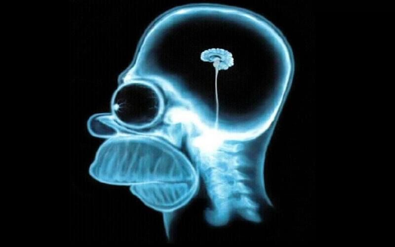 X-ray