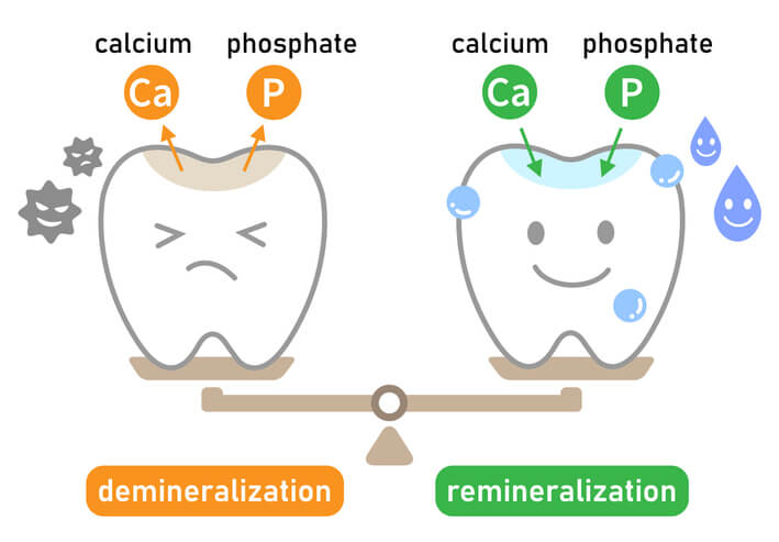 The process of tooth demineralisation and remineralisation